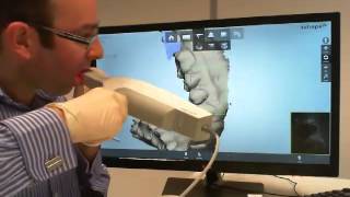 Intra Oral scanning with 3Shape TRIOS [upl. by Farmer]