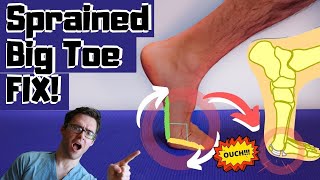 BEST Sprained Big Toe Joint Treatment Turf Toe Treatment amp Exercises [upl. by Itnava769]