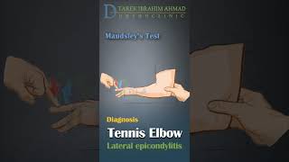 how you know if you have tennis elbow [upl. by Ledda]