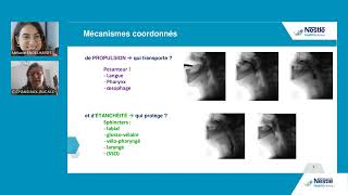 Replay Webinaire  Prise en charge des troubles de la déglutition en cas de maladies neurologiques [upl. by Ahsekam250]