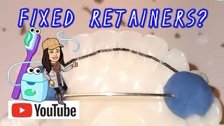 Permanent Fixed retainers after Braces amp Invisalign  What where how why [upl. by Akemat]