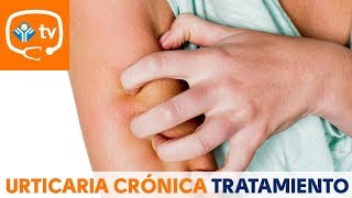 Me muero de picores ¿hay algún tratamiento eficaz contra la urticaria crónica [upl. by Neerual]