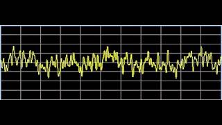 Thalamic Diseases  Rife Frequencies [upl. by Harlen625]