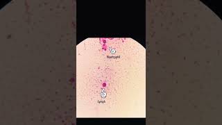 sputum smear [upl. by Farika202]