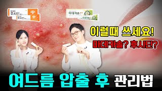 여드름 짜고 후시딘 마데카솔 여드름패치 올바른 여드름압출 후 관리방법 [upl. by Market]