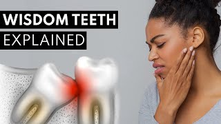 Wisdom Teeth Explained Pain Symptoms amp Extractions [upl. by Doria]