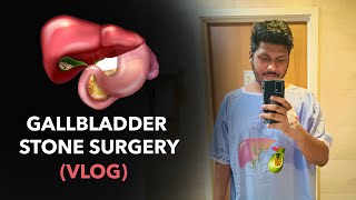 What to Expect After Gallbladder Surgery  vlog [upl. by Leahey]