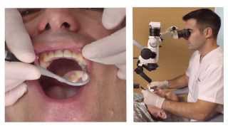 How to position a Labomed Prima DNT Dental Microscope English [upl. by Nosreh]