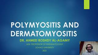 8 PolymyositisDermatomyositis PMDM [upl. by Fogg]