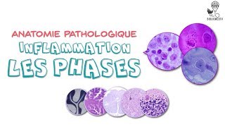 Anatomie Pathologique  Phases de lInflammation [upl. by Layney]