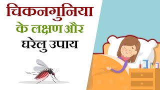 चिकनगुनिया के घरेलू उपचार  Chikungunya home remedies in hindi [upl. by Anahsar]