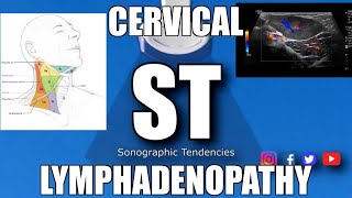 Sonoquickies  Cervical Lymphadenopathy [upl. by Esinek]