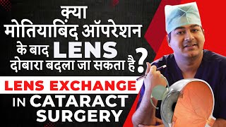 Lens Exchange After Cataract Surgery  क्या मोतियाबिंद ऑपरेशन के बाद लेंस दोबारा बदला जा सकता है [upl. by Pickens]