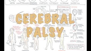 Cerebral Palsy  DETAILED Overview [upl. by Eniamreg]