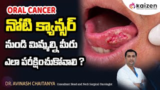 Mouth cancer treatment  నోటి క్యాన్సర్  DrAvinash Chaitanya  Kaizen Hematology Oncology Network [upl. by Eanehs]