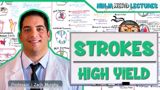 Ischemic and Hemorrhagic Strokes  High Yield [upl. by Mott]