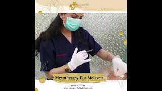 Mesotherapy For Melasma by Skinsmith [upl. by Apurk]