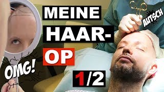 Ablauf im OP  Vlog  Meine 1 Haartransplantation OP Geheimratsecken – Grey Young [upl. by Anul]