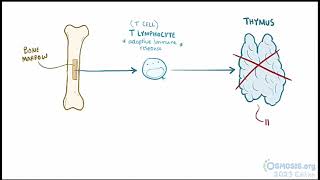 Digeorge Syndrome Osmosis [upl. by Hirsh845]