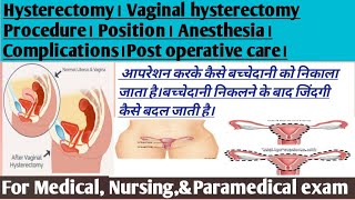 Vaginal hysterectomy Procedure in Hindi Hysterectomy uterus removal surgery in hindicomplications [upl. by Crispin]