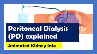 Peritoneal Dialysis explained [upl. by Aelyk]