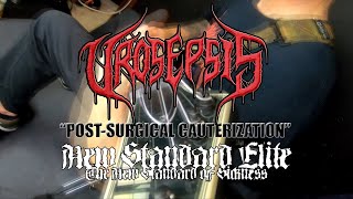 UROSEPSIS  quotPostSurgical Cauterizationquot Guitar Playthrough New Standard Elite  2022 [upl. by Eirased]