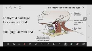 cmmon carotid artery and ICC and ECA [upl. by Oruam]