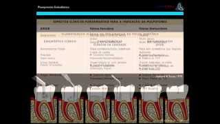 Planejamento do Diagnóstico e Tratamento Endodôntico [upl. by Alleuqram]