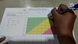 HOW TO PARTOGRAPH  LABOR MONITORING [upl. by Aetnuahs]