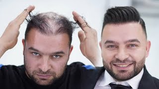 Thinning Haircut Transformation l Makeover for special Occasion [upl. by Lebezej]