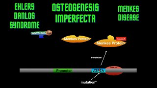 USMLE Step 1  Lesson 23  Osteogenesis Imperfecta Ehlers Danlos Syndrome and Menkes disease [upl. by Marylynne]