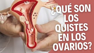 😨💔¿Qué son los QUISTES ováricos Todos los detalles [upl. by Edivad]