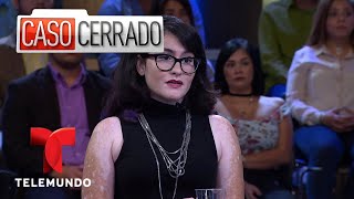 Discriminación Por Vitíligo🙅👎😭 Caso Cerrado  Telemundo [upl. by Airbmat612]