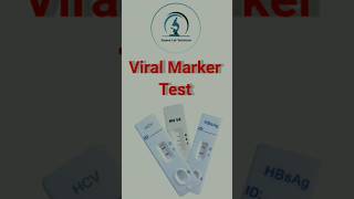 Viral Marker Test  Hematology shortsvideo medicallaboratorytechnician pathologylab [upl. by Eejan]