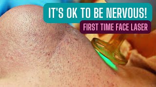 FIRST TIME LASER HAIR REMOVAL  FULL FACE [upl. by Nebra]