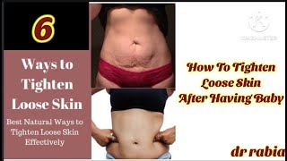 6 Tips to Tighten Loose Belly Skin After PregnancyHow to tighten loose doin after having baby [upl. by Ansela731]