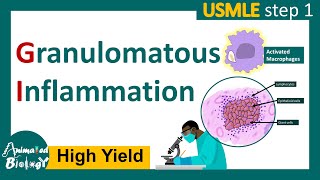 Granulomatous inflammation  What causes granulomatous inflammation  Pathology for USMLE step 1 [upl. by Elnukeda950]