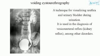 voiding cystourethrography [upl. by Gosnell]