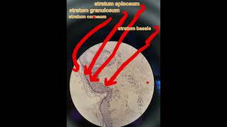 Layers of epidermisskindermapathHandEhistologypathologymedical [upl. by Kablesh637]