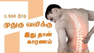 Causes of Lower Back Pain  Reasons medication treatment and home remedies  Tamil Health Tips [upl. by Faith]