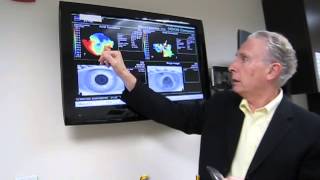 DR BOSHNICK EXPLAINING CORNEAL TOPOGRAPHY PATIENT 4 [upl. by Dam517]