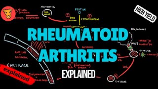 RHEUMATOID ARTHRITIS Pathogenesis EULAR Guidline diagnostic criterias Xray Treatment [upl. by Mathian]