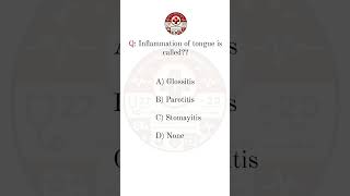 Inflammation of tongue bscnursing neet medico nursing anatomy gnm hospital mbbs Glossitis [upl. by Mimi179]