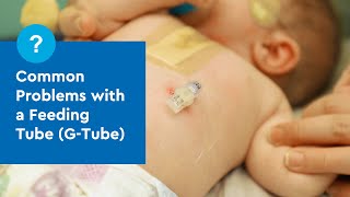 Common Problems with a Feeding Tube GTube [upl. by Jareen]