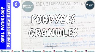 Fordyces Granules  Dr Paridhi Agrawal [upl. by Geraldine889]