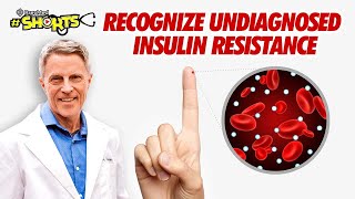 SHORTS Recognize Undiagnosed Insulin Resistance [upl. by Ardelia]