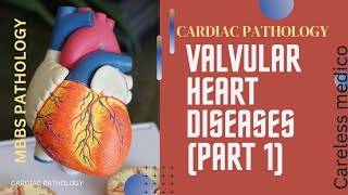 CARDIAC PATHOLOGY VALVULAR HEART DISEASES lecture 10patho cvs mbbs pathoma robbins [upl. by Aylat]