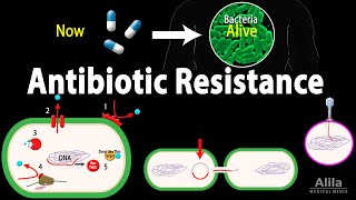 Antibiotic Resistance Animation [upl. by Anaitat690]