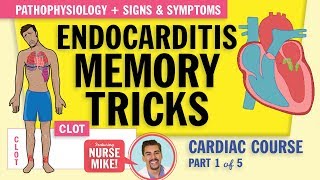 Endocarditis Pathophysiology signs and symptoms for nursing students NCLEX review [upl. by Minabe]