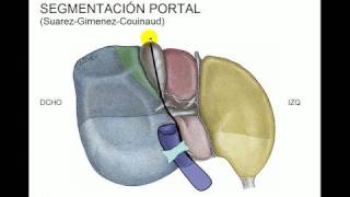 Segmentacion hepática [upl. by Akenahc620]